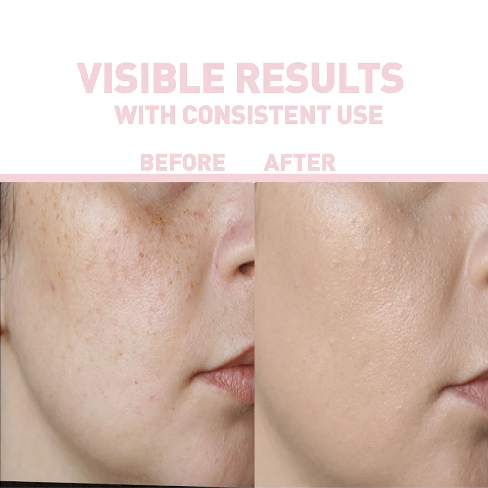 Bionnex - The Nordea Revitalizing Vitamin C Serum For All Skin Types