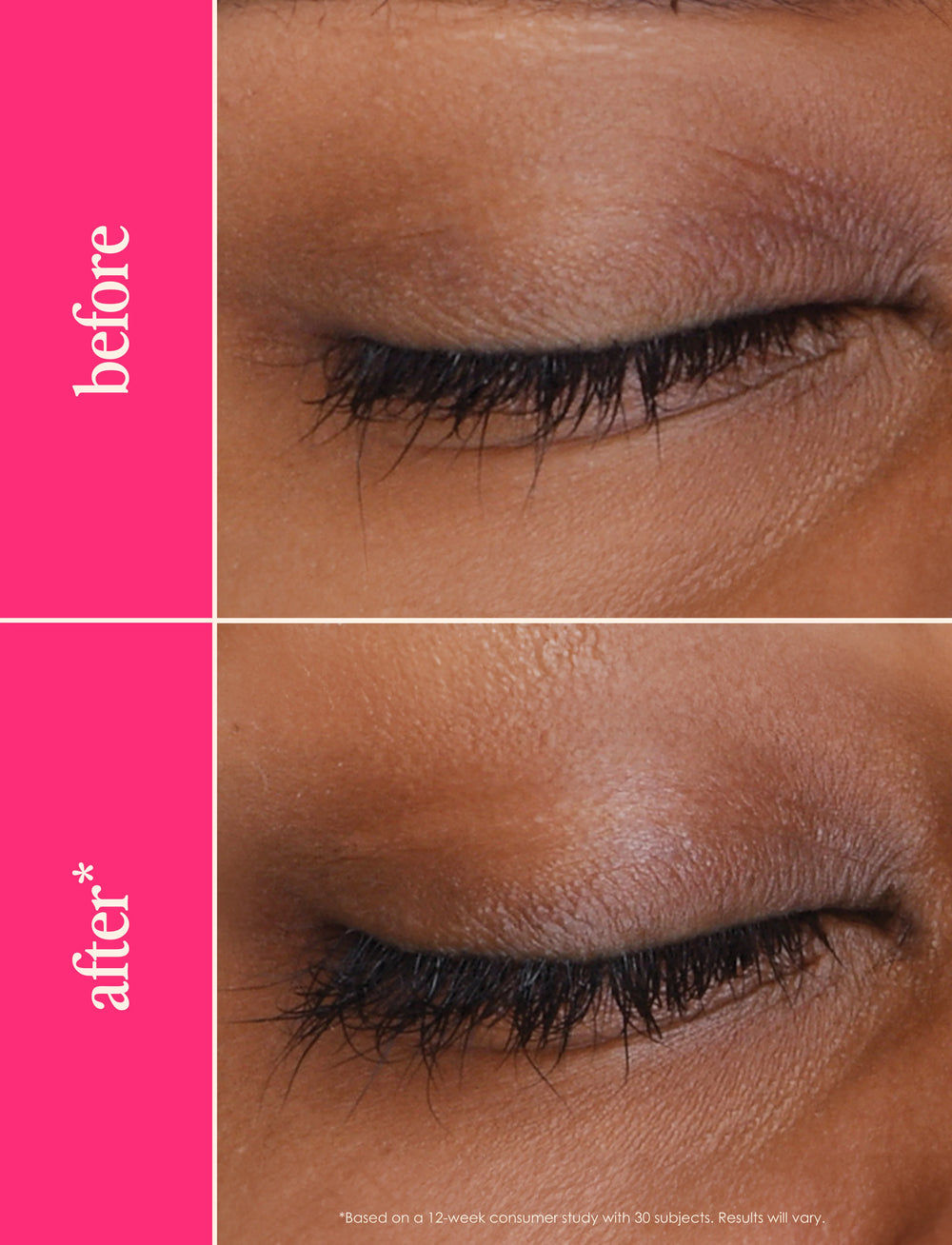 Grande Cosmetics -  GrandeLASH-MD Lash Enhancing Serum