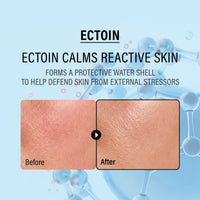epii - Double Up Cream Ectoin & Panthenol 50ml